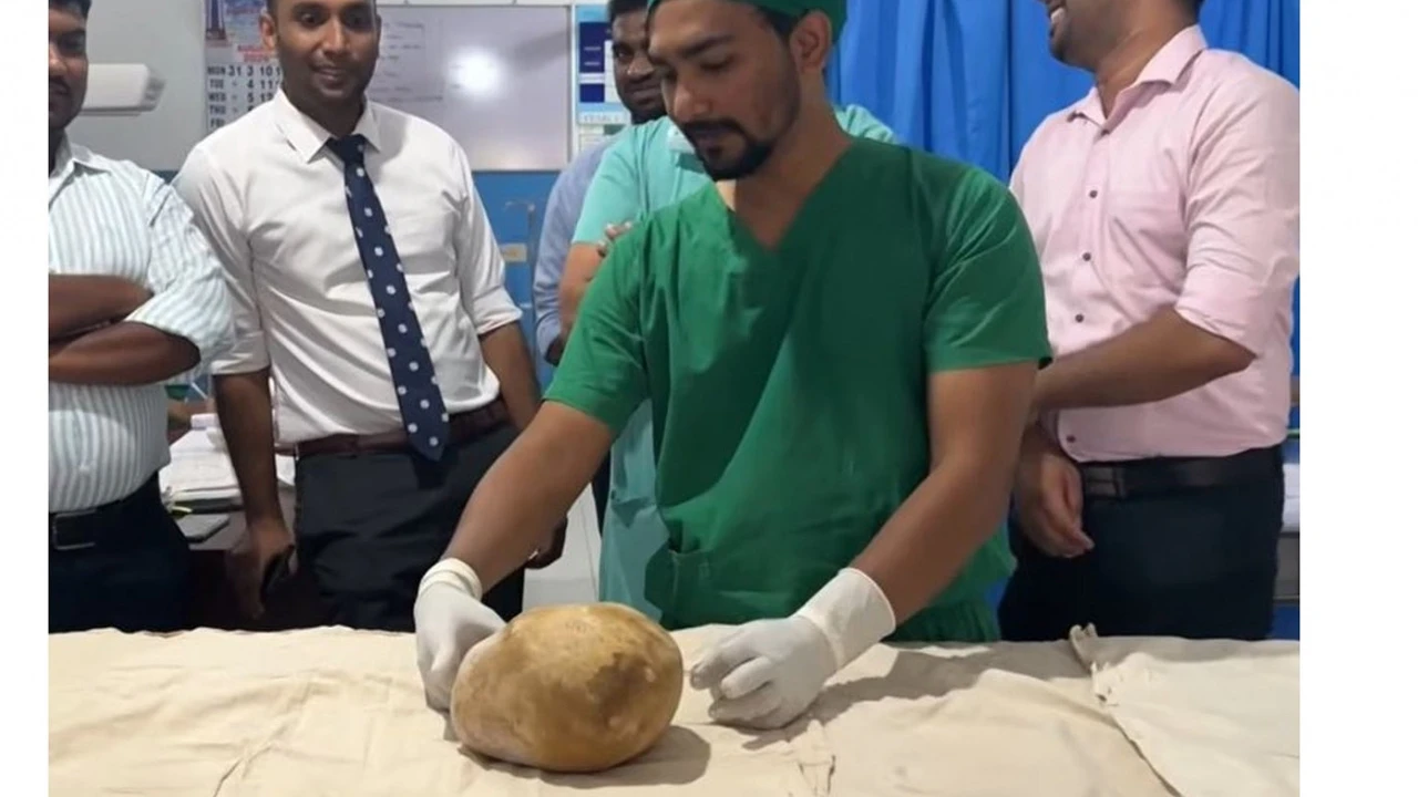মূত্রথলি থেকে বের করা হল ৩.১ কেজি ওজনের পাথর